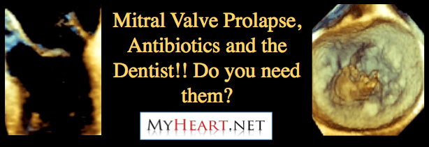 Mitral valve prolapse, antibiotics, dental procedures,